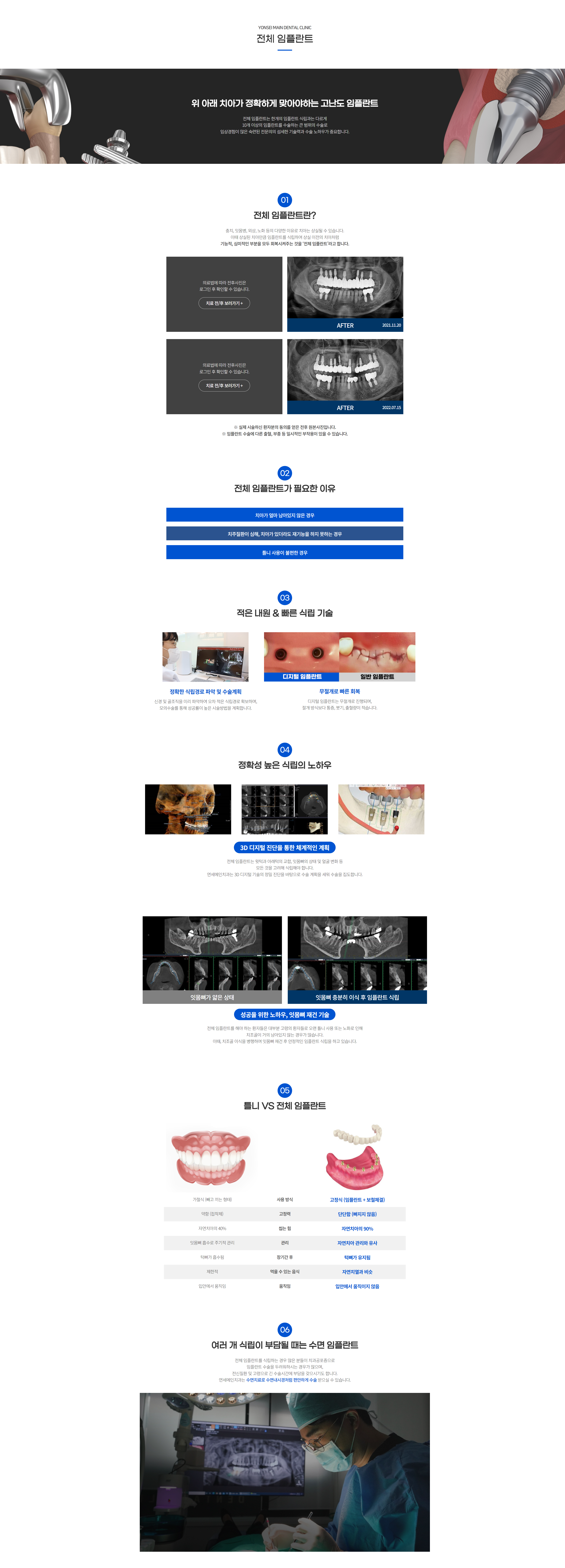 전체임플란트.png