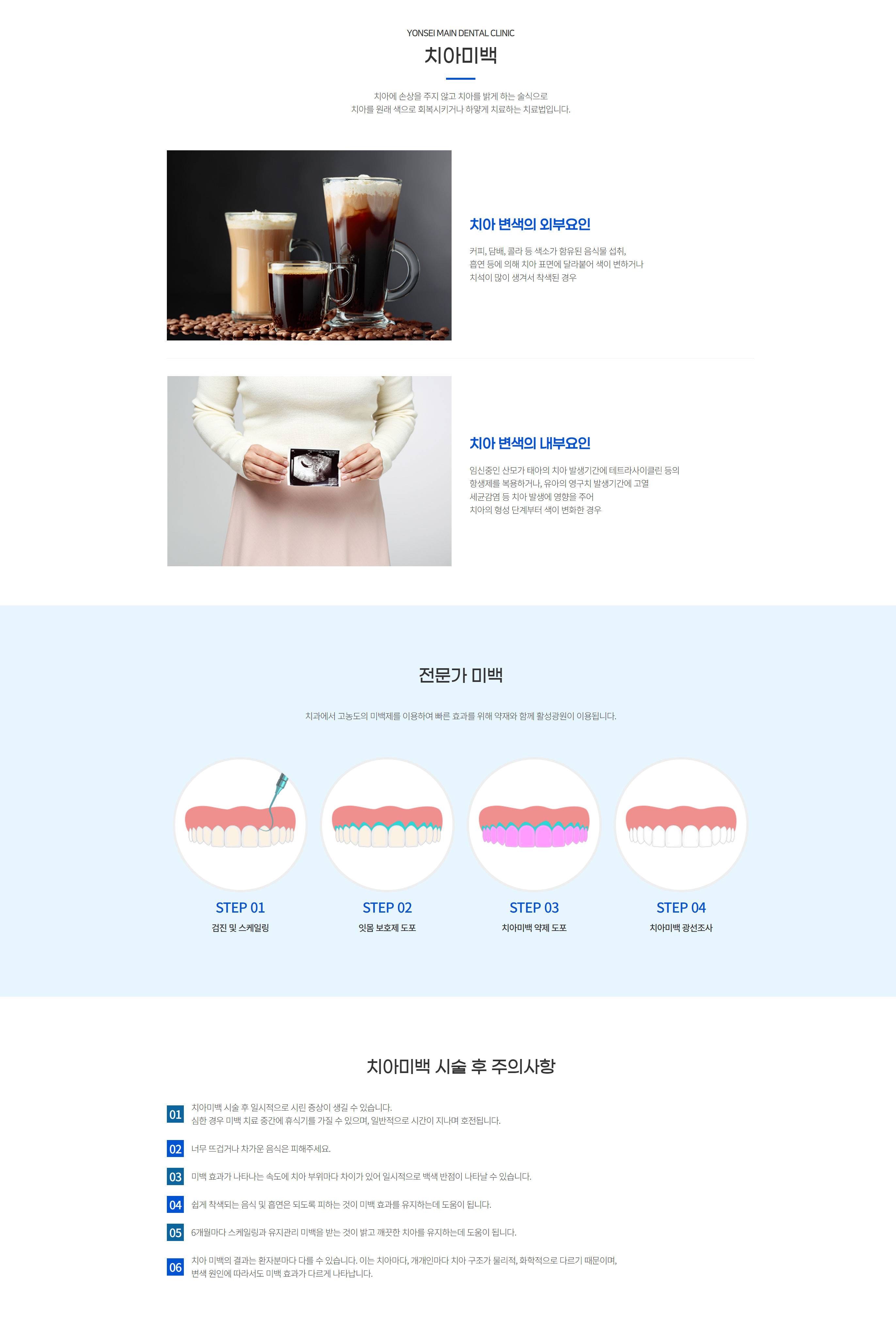 치아미백.png